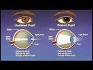 Eye Dilation - Family EyeCare & Contact Lens Center