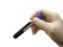 What is PHLEBOTOMY? | PHLEBOTOMY Technician Headquarters