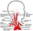 carotid artery