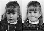 <b>Mobius syndrome</b> is nothing to