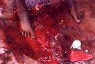 female circumcision « Diary of a Sutton Councillor