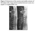 not occur with <b>spinal TB</b>.