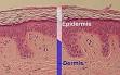250px-<b>Epidermis</b>-delimited.JPG