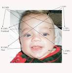 CN7 - <b>Facial Nerve</b>