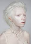 Well Thats Lovely (16 year old Nastya Kumarova, an albino model.