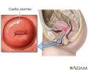 El <b>cuello</b> uterino es la