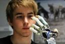 ... pelo Dr. Oskar Aszmann conseguiu preservar a funcionalidade de sua mão. - bionic-prosthetic