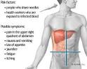 with <b>alcoholic cirrhosis</b>,
