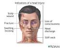 In <b>penetrating head injuries</b>,