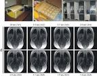 ScienceDirect.com - Academic Radiology - Rapid Volumetric MRI