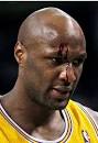 LAMAR ODOM has a bloody head after a collision.