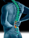 VerMar Saúde: <b>Espondilite</b> Anquilosante
