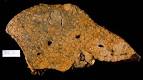 <b>Hepatitis</b>