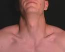 Surface Anatomy - Cervical