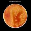 <b>Serratia marcescens</b>