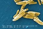 Mycobacterium <b>tuberculosis</b>