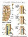 Friends - <b>Arachnoiditis</b>