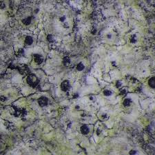 Image result for Bactrospora corticola
