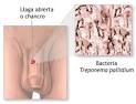 <b>enfermedades</b> de <b>transmision</b>