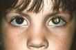 <b>Retinoblastoma</b> is cancer of