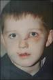 Nathan Thomson. Nathan was slashed across the face, leaving a permanent scar - _44487868_nathanthomson203x300