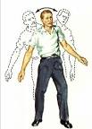 What is <b>Ataxia</b> ?