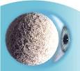 Bio-Eye <b>Orbital Implants</b> -