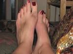 File:Human Feet - female - bruised.jpg - Wikimedia Commons