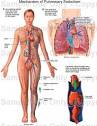 Mechanism of PULMONARY EMBOLISM - Medical Illustration, Human ...
