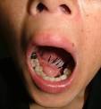 <b>sublingual gland</b> (arrows).