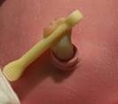 <b>Umbilical Cord</b>