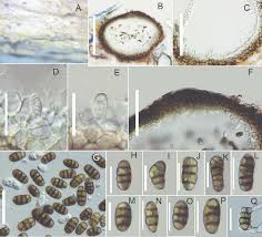 Image result for Camarosporium tamaricis