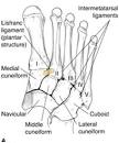 LISFRANC INJURY (Tarsometatarsal fracture-dislocation) - Foot ...