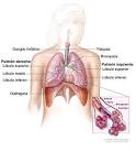 Cáncer de <b>pulmón</b> de células pequeñas: Tratamiento (PDQ