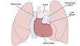 HEART TRANSPLANTation - Wikipedia, the free encyclopedia