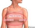 Dolor de <b>Mama</b>