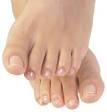 Flat Feet and Knee Pain