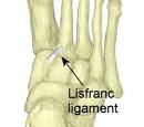 The Complacency Chronicles: COLUMN: Lisfranc