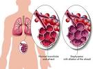 <b>Emphysema</b> – Causes , Symptoms