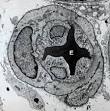 Endothelium - Wikipedia, the free encyclopedia