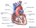 <b>Aortic arch syndrome</b>