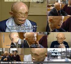 the top pic is Hiroshima,