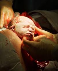 Sezeryan dogum nasil olur?bebek dogarken- bebek mother giving birth with incision Cesarean