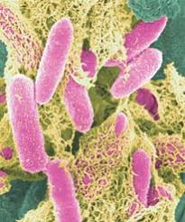 E-coli-in-color.jpg‎ (206