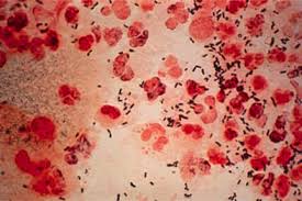 Picture of Gonorrhea bacteria