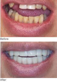 your beautiful smile is