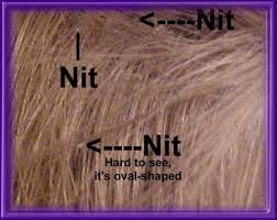 Below are pictures of nits