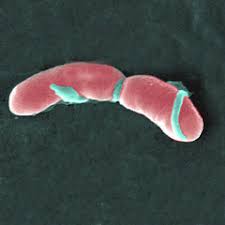 bacteria listeriosis