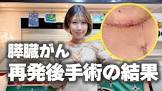 サニージャーニー