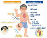 腹覚